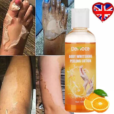 Dark Skin Whitening Cream Face & Body Knuckle Bleaching Peeling Dark Spot Remove • £7.95