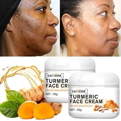 2X Turmeric Face Cream Dark Spot Corrector Remove Wrinkles Freckle Brightening • £11.95