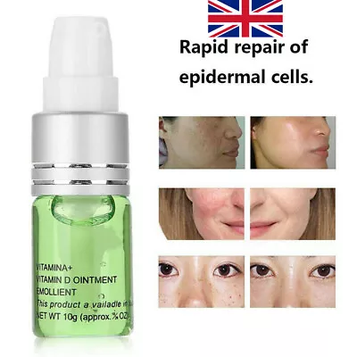Painless Mole Skin Spot Removal Face Wart Tag Freckle Treatment Repair Cream • £2.39