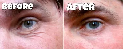 WATCH OUR AMAZING VIDEO Instant Facelift Remove Reduce Deep Wrinkles Cream Serum • £5.99