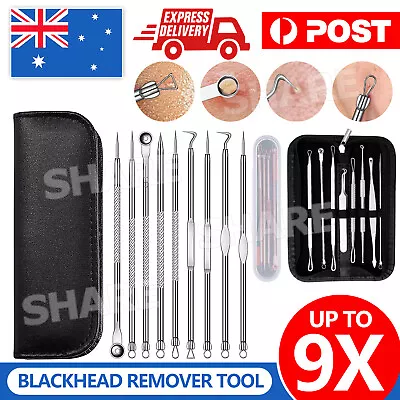 $6.65 • Buy 4/8/9pc Blackhead Remover Extractor Tool Pimple Blemish Popper Comedone Kit Clip