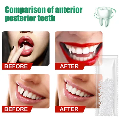 Teeth Gap Solid Glue Resin Wrong Teeth Temporary Tooth Repair Denture ┛ • £4.40