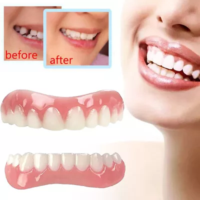 Tooth Cover Upper Lower Teeth Veneers Snap On Dentures False Dental Whitening • $11.59