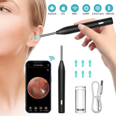 JesHome Ear Wax Remover Camera Ear Endoscope Spoon Pick Ear Otoscope Cleaner UK • £16.99