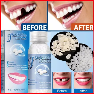 Tooth Repair Beads Granules Temporary Tooth Glue Reusable Moldable False Teeth • $8.78