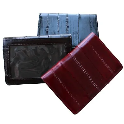 Genuine Eel Skin Leather Trifold Wallet Credit Card Wallet Men's Purse • $24.99