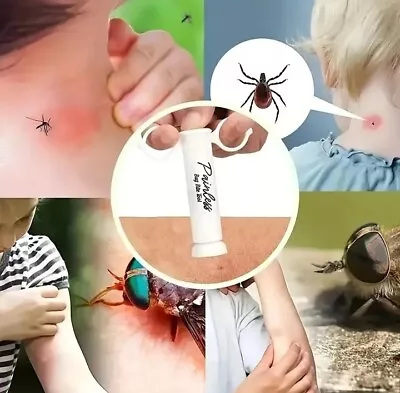 HOT Itch Relief Bite Relief Suction Chemical Free Insect Bite Relief Mosquito 🐝 • £5.25