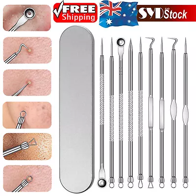 $2.25 • Buy Blackhead Remover Tool Pimple Blemish Popper Comedone Acne Cleaner Kit Clip 9pcs