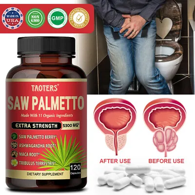 Saw Palmetto 120 Capsules Extract 5300mg Prostate Hair Loss Urinary Tract • $13.79