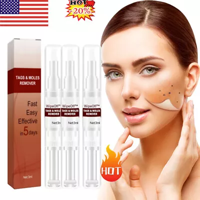 1pcs Wipe Off Skin Tags & Moles Removal Quick Safe Remover Restore Skin Painless • $2.99