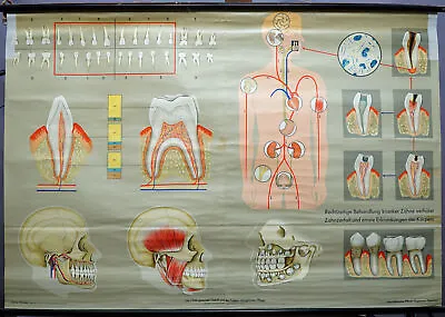 Human Teeth Medical Poster Vintage Rollable Wallchart • $215.99