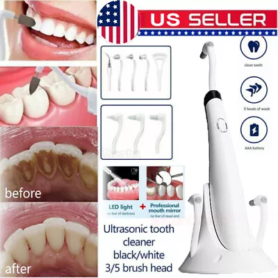 5 In 1 Tooth Polishing Cleaner Ultrasonic LED Electric Oral Teeth Cleaning Kit ~ • $15.65