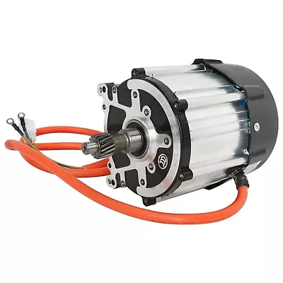 72V 1500W Electric Brushless Differential Motor For Go Kart ATV Quad Tricycle • $185.59