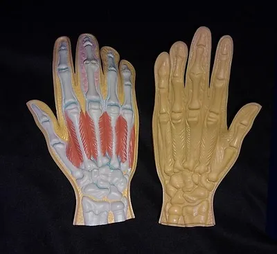 Enbrel Psoriasis Hand Muscles Bones Ligaments Anatomical Model Anatomy • $39.95