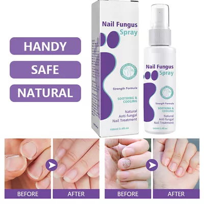 1x3x Instant Effective Medinail Fungus Repair Spray Treatment For Toenail Nail • £5.89