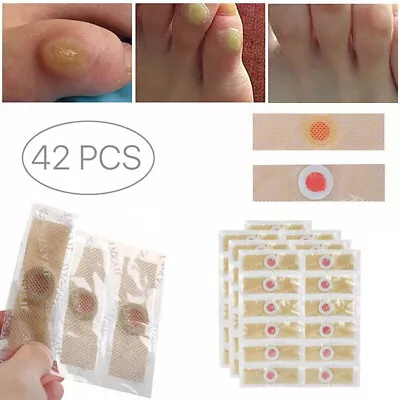 42/84X Foot Corn Remover Pads Plantar Wart Thorn Plaster Patch Callus Removal • £5.31