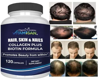 Hair Gain Biotin Hydrolyzed DHT Blocker Hair Growth Vitamins 2500000  Women Men • $13.55