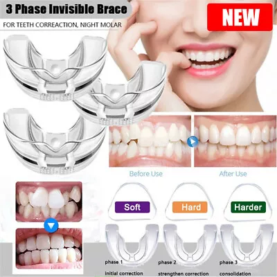 3 Stages Dental Orthodontic Teeth Corrector Brace Tooth Retainer Straighten Tool • £2.39