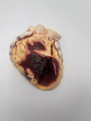 Vintage Heart Myocardial Infarction Heart Attack Anatomical Pathology Model • $39.95