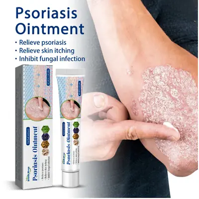 Psoriasis Ointment Skin Treatment • $17.80