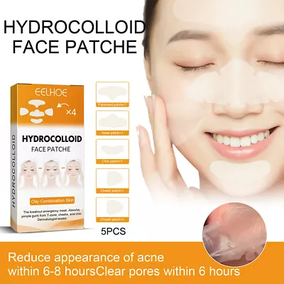 $2.77 • Buy 20pcs Mighty Patch Nose Pores Cleansing Cosmetics Hydrocolloid Blackhead Patches