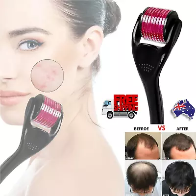 Derma Roller Derma Roller Titanium Hair Regrowth Beard Growth Anti Hair Loss • $13.99