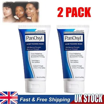 New Acne Foaming Wash Face & Body 156g Peroxide All Skin Types 5.5oz • £15.98