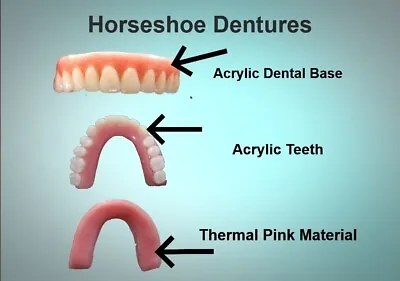 DIY Denture Horseshoe UPPER Temporary Dentures / DIY Denture / MEDIUM • $85