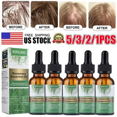 $6.95 • Buy 5/3x Rosemary Essential Oil 100% Natural Hair Loss Therapeutic Grade Hair Growth