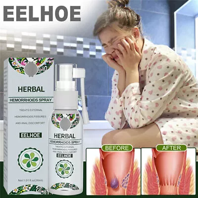 £4.20 • Buy 30ML Hemorrhoid Treatment Spray Natural Herbal Essence No Stimulation Spray UK .