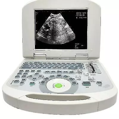 Portable USB For Laptop Ultrasound Scanner Probe: Medical Imaging System • $1799