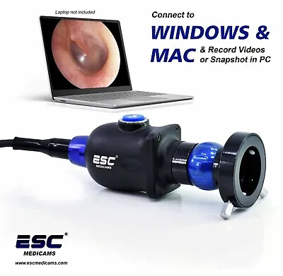 HD Portable USB Endoscope Camera For Storz ENT Medical 1.2MP Windows Compatible • $599