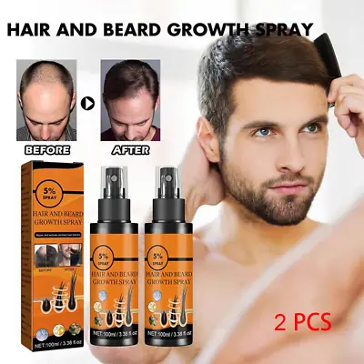 2 PCS 5% Minoxidil Hair Growth Spray For Men Women 100ml Treatment Regrowth Hair • £10.99