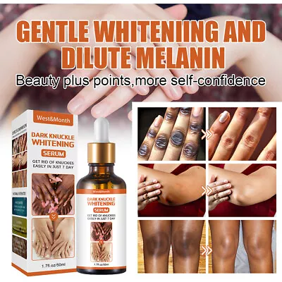 $8.95 • Buy Orange Peeling Lotion Body Whitening Cream Lightening Brightening Skin Care