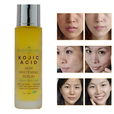 $15.87 • Buy KOJIC ACID Skin Whitening Lightening Brightening Serum Bleaching/Spot Fade Cream
