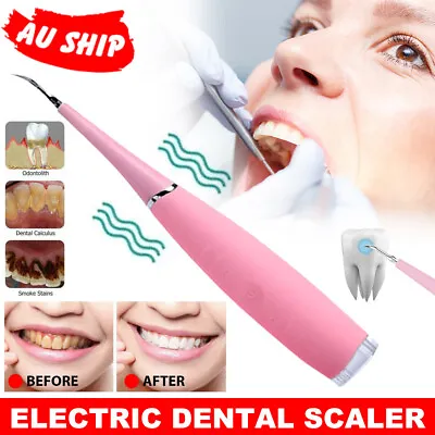 $14.95 • Buy Teeth Whitening Tooth Cleaner Dental Tool Scaler Tartar Remover Electric Sonic