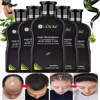 Fast Hair Growth Shampoo For Women Men Anti Hair Loss Treatment Hair Thickening • £9.25