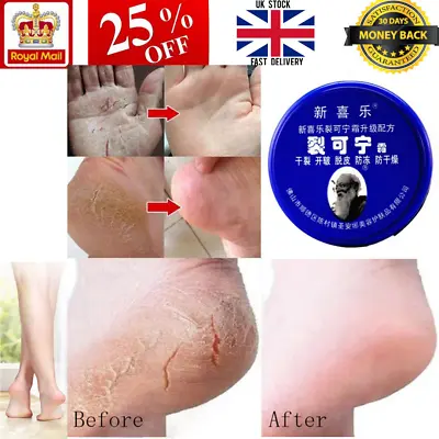 £8.99 • Buy Working Hand Cracked Foot Cream Skin Dry Split Wrinkle Peeling Repair Balm UK