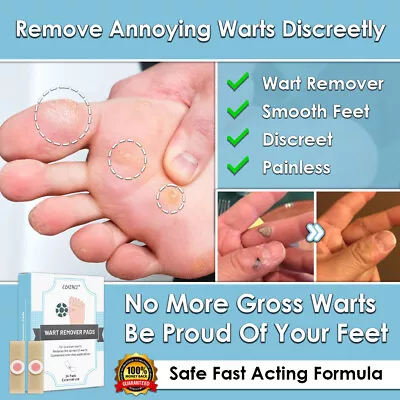 New 24 Wart Remover Plasters Ointment Pain Relief Treatment Elaimei Verruca • £9.95