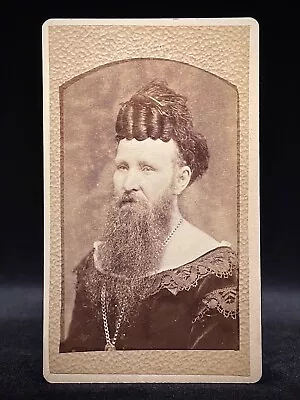 Very Rare Circus Cdv - Bearded Lady With Crazy Hair - 19th C Sideshow Freak • $395