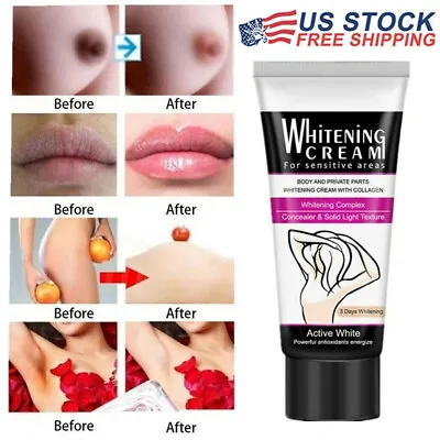 $9.35 • Buy 3 Days Dark Skin Permanent Bleaching Lightening Whitening Cream For Face & Body
