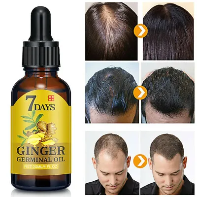 30 Ml 7 Day Ginger Germinal Serum Oil Natural Hair Loss Treatement Effective  • $12.65