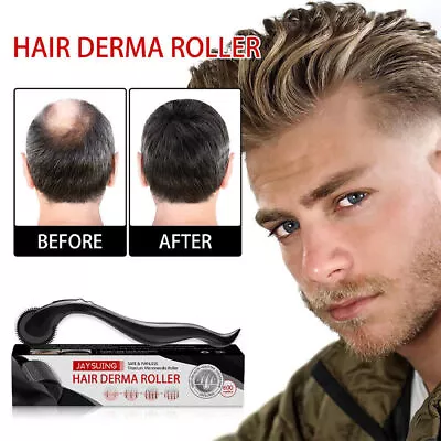 Derma Roller Micro Needle Titanium Skin Care Beard Hair Regeneration Growth Hot • $12.19