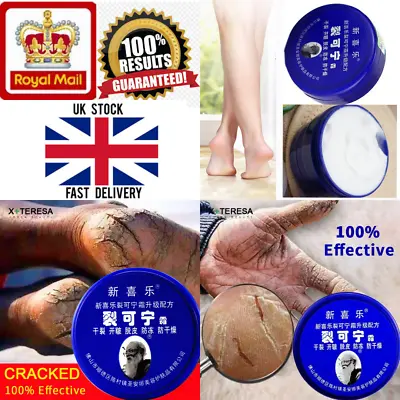 £8.99 • Buy Working Hand Cracked Heel Foot Cream Skin Dry Split Wrinkle Peeling Repair Balm
