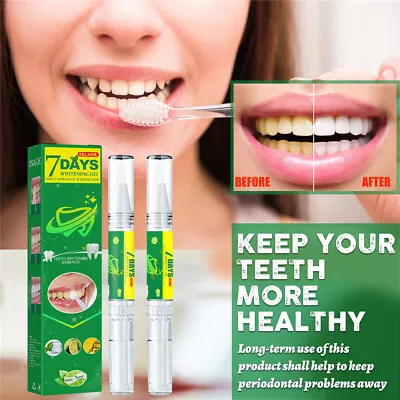 7 Days Teeth Tooth Whitening Gel Pen White Bleaching Dental Whitener Teeth Care • $10.92