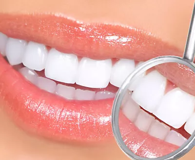$310.40 • Buy Thermoforming Teeth Whitening Mouth Dental Trays 4 X Brand New