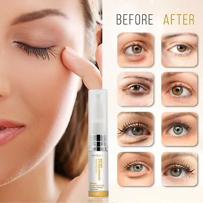 Dermaxgen® INSTANT EYEBAG REMOVER DARK CIRCLES FINE LINESPUFFINESS WRINKLES • $14.95