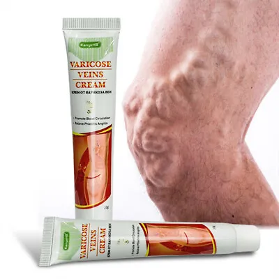Varicose Veins Cream Blood Circulation Vein Defense Cream Body Leg Care • £4.14