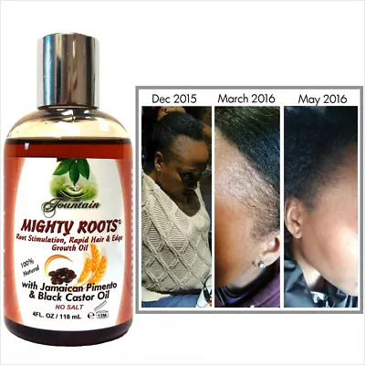 Fountain  Receding Hair Growth Oil With Jamaican Pimento And Black Castor Oil • $17.49