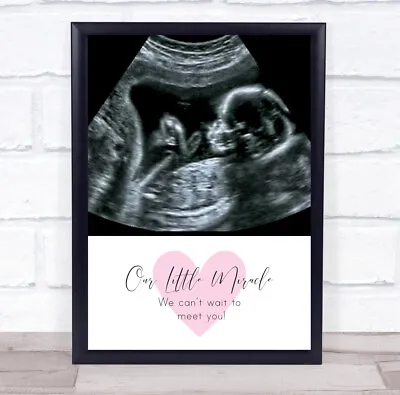 Baby Pregnancy Ultrasound Scan Photo Our Little Miracle Personalised Gift Print • £10.79